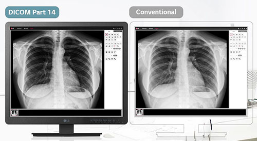 DICOM Part 14 Compatible