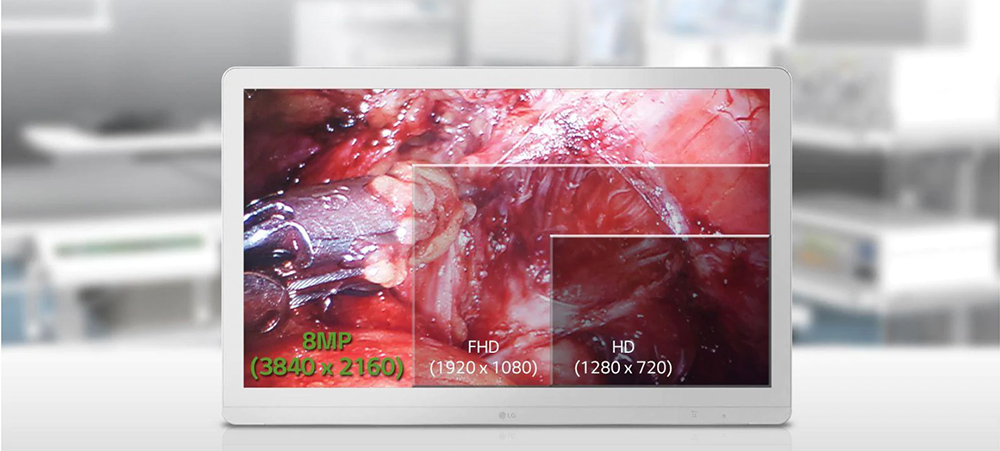 A Display Optimized for the Operating Room