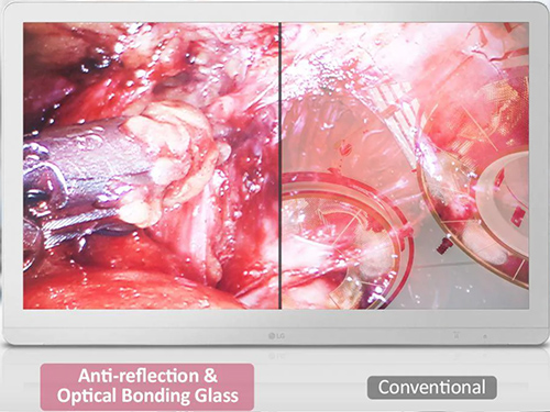 Anti-reflection & Optical Bonding Glass