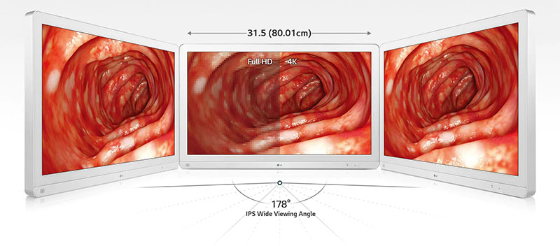 Enhanced Accuracy with Wide View