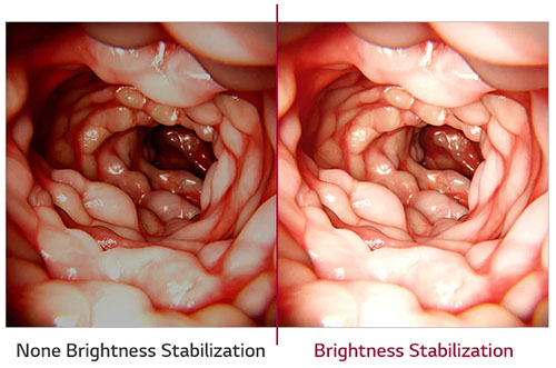 Brightness Stabilization